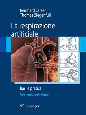 cover image of La respirazione artificiale